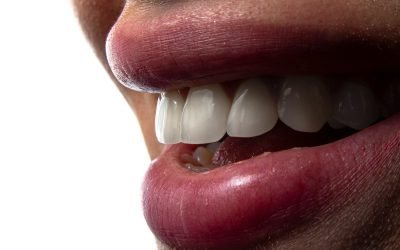 un gros plan de la bouche d'une personne avec des dents visibles