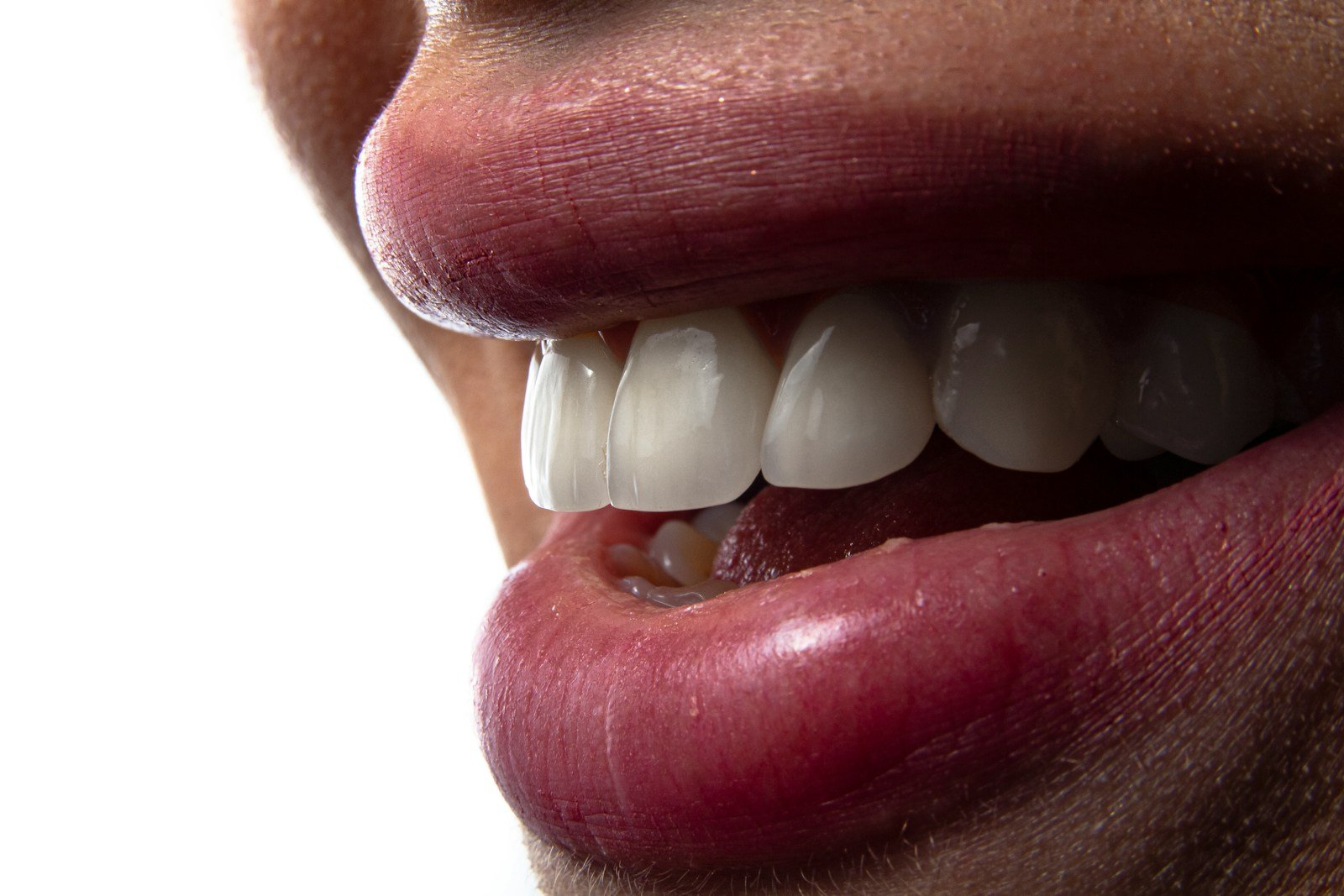 un gros plan de la bouche d'une personne avec des dents visibles